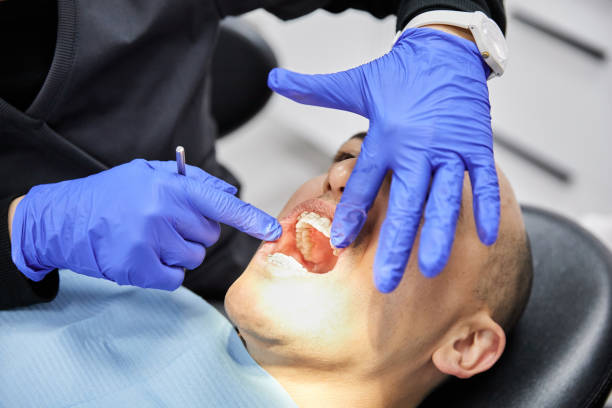Best Emergency Treatment for Oral Infections in Dixon, MO